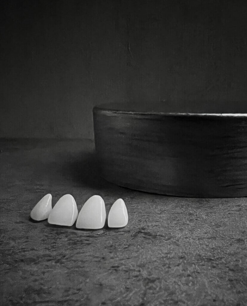 all ceramic crowns 826x1024 1